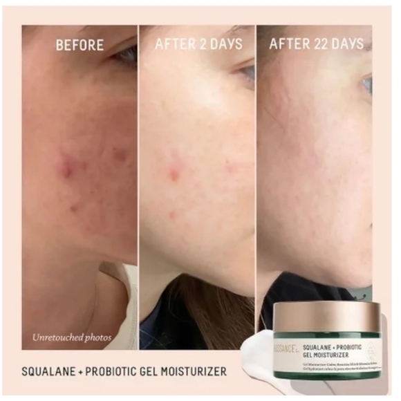 NEW Biossance Squalane Probiotic Gel Moisturizer Vegan Plant Based 1.69 fl oz - Picture 9 of 13